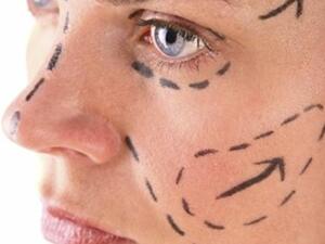ما هي جراحات التجميل الأكثر شيوعا اليوم؟