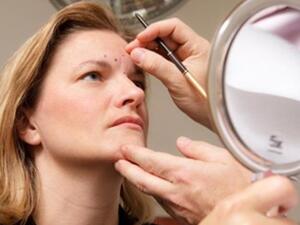 ما هي حقن التعبئة ( الفيلر)؟