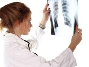  

الأشعة السينية X ray، هي نوع من الأشعة الكهرومغناطيسية بطول الموجة من 10 إلى 0.01 نانو متر