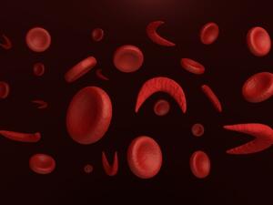 من أعراض نقص الهيموجلوبين احمرار لون اللسان

