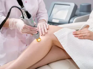 عند إزالة الشعر بالليزر يختلف الإحساس بالألم من فرد إلى آخر