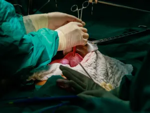 عملية زراعة الكبد هي عمليّة يتم فيها نقل جزء من كبد سليمة إلى شخص مصاب بالفشل الكلوي