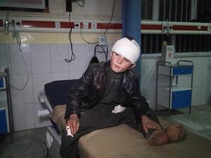 A young wounded Afghan boy receives treatment at Wazir Akbar Khan hospital in Kabul on November 28, 2018. (AFP/File)