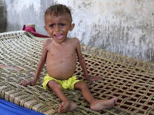 A malnourished Yemeni boy sits on a wooden bench. (AFP)