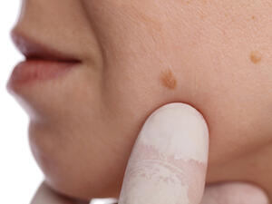  احرصي على تناول الأطعمة الغنية بفيتامين C وفيتامين A بكثرة