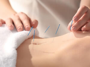 الإبر الصينية تعالج حالات الأرق والإرهاق
