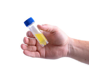 يتغير البول إلى اللون البرتقالي بسبب الأدوية خاصة المضادات الحيوية
