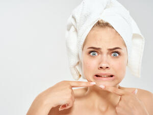 الاضطرابات الهرمونية  سبب ظهور الحبوب في الوجه قبل الدورة الشهرية