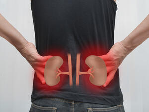 يعتبر مرض الحصى بالكلى من المشاكل الشائعة والمنتشرة