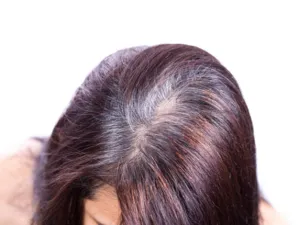 تغطية الخصلات البيضاء أثناء الحمل
