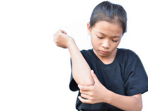  الجرب عبارة عن مرض يسبّب ظهورَ حكّة شديدة