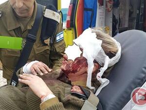 المجند والمجندة الاسرائيليين أصيبا بجروح في الرأس نتيجة تعرضهما لإلقاء الحجارة 