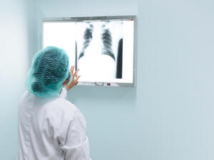 من أسباب التهاب الرئة ضعف في مناعة الجسم

