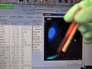 المنشطات جزء لا يتجزأ من كرة القدم شئنا أم أبينا