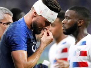 جيرو يتعرض للإصابة