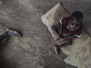 An official famine was declared in South Sudan in February, and hundreds of thousands of children are at risk of starvation. (AFP) 