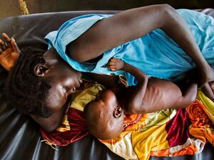 This file photo taken on October 11, 2016 shows a mother breastfeeding her child who suffers acute malnutrition at the clinic run by Doctors Without Borders (MSF) in Aweil, northern Bahr al-Ghazal, South Sudan. (AFP/Albert Gonzalez Farran