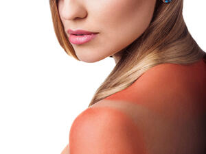 البابونج يعالج الالتهابات والتهيّجات التي حدثت للبشرة نتيجة التعرض لأشعة الشمس