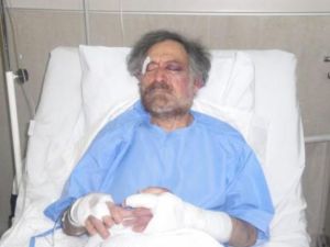 علي فرزات