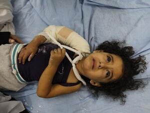 طفلة جريحة/أ.ف.ب