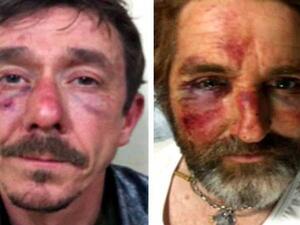  انثوني لويد مراسل صحيفة “تايمز″ الذي اعتقله مقاتلو المعارضة مع زميل له في 2014