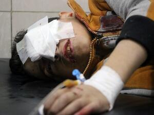 أحد الأطفال الجرحى من مدينة حلب