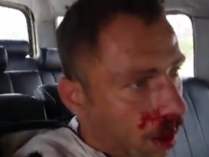 انتحاري حاول تفجير نفسه بالقرب من مستشفى جبلة