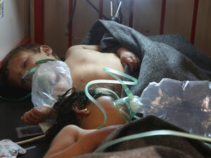 Children being treated for exposure to a chemical weapon in Idlib, Syria, on 4 April 2017. (AFP)