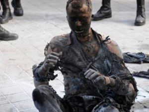 مصاب من تفجير ارهابي في تونس / ارشيفية