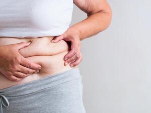 Weight loss surgery is a growing trend in Jordan. (Shutterstock)