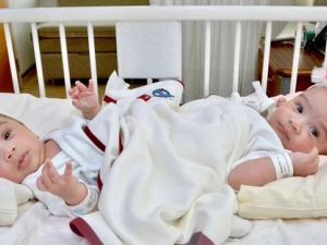 Saudi Siamese twins Sheikha and Shumukh  (Twitter)