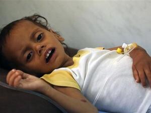 A Yemeni child receives treatment at a hospital in the coastal city of Hudaydah on November 11, 2017. (AFP/ File Photo)