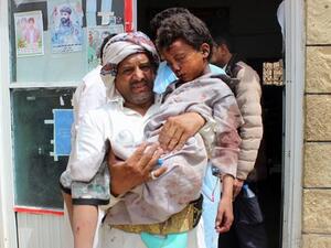 A man carries a wounded child to the hospital Thursday after the Saudi-led coalition carried out an airstrike on a crowded area in Houthi-controlled Saada province. (AFP/File)