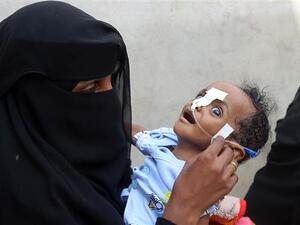 A Yemeni woman carries a malnourished child as she waits during food distribution in the province of al-Hudaydah in western Yemen, May 30, 2018. (AFP)