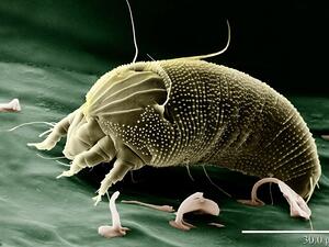 Just a gram (about half a teaspoon) of the fine dust found in AC vents can contain up to 1,000 dust mites. Yuk. (Pixabay) Just a gram (about half a teaspoon) of the fine dust found in AC vents can contain up to 1,000 dust mites. Yuk. (Pixabay)