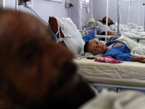In this photograph taken on May 21, 2015, an Afghan child receives treatment at the Medecins Sans Frontieres (MSF), or Doctors Without Borders, hospital in the northern city of Kunduz. (AFP/Shah Marai)