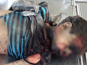 Attack on school bus in Yemen (Twitter)