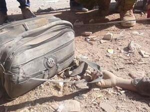 حقيبة طفلة لقيت حتفها في غارات النظام