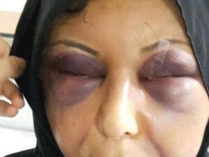 آثار التعنيف على السيدة زهراء صبحي تغني عن أي تعليق