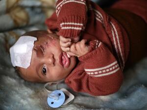 تحدث المرصد الاثنين عن مقتل 80 مدنيا، بينهم ستة أطفال