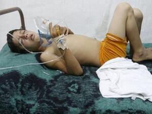 اتهام النظام باستخدام غازات سامة قرب دمشق