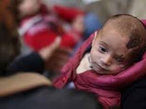 A symbol of resistance to Syria’s Assad regime, “Baby Karim”, who lost one eye to a regime airstrike (AFP/File Photo)

