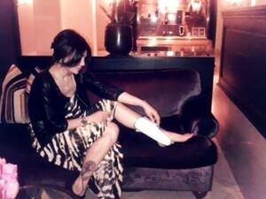 Haifa showing her injured foot