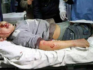 مئات الشهداء وآلاف الجرحى جراء العدوان الإسرائيلي المتواصل على قطاع غزة