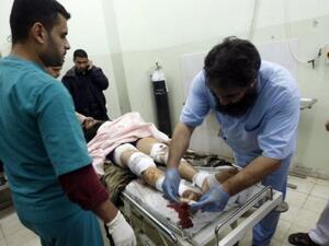 ممرضون يقدمون الاسعافات لجريح فلسطيني في مستشفى ناصر في خان يونس