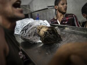 اصيب اكثر من 10 الاف فلسطيني في الحرب على غزة منهم 7 الاف من النساء والاطفال 