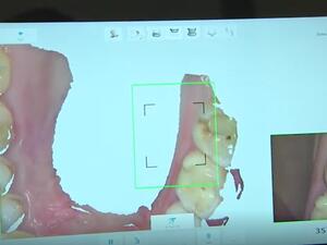 تقنيات جديدة في خدمة طب الأسنان