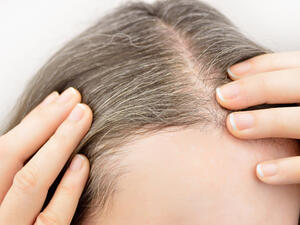 التدخين يمكن أن يسرع تغير لون الشعر، والشيب المبكر 