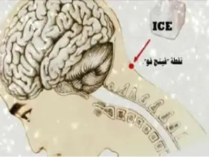 وضع مكعبات الثلج على الرقبة يعمل على معالجة اضطرابات الغدة الدرقية