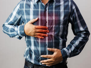 يمكن السيطرة على الحرقة بتناول الطعام باعتدال وتجنب الأغذية الزيتية